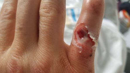 SBK 1000 – Schock für Kawasaki: Mathieu Gines verletzt